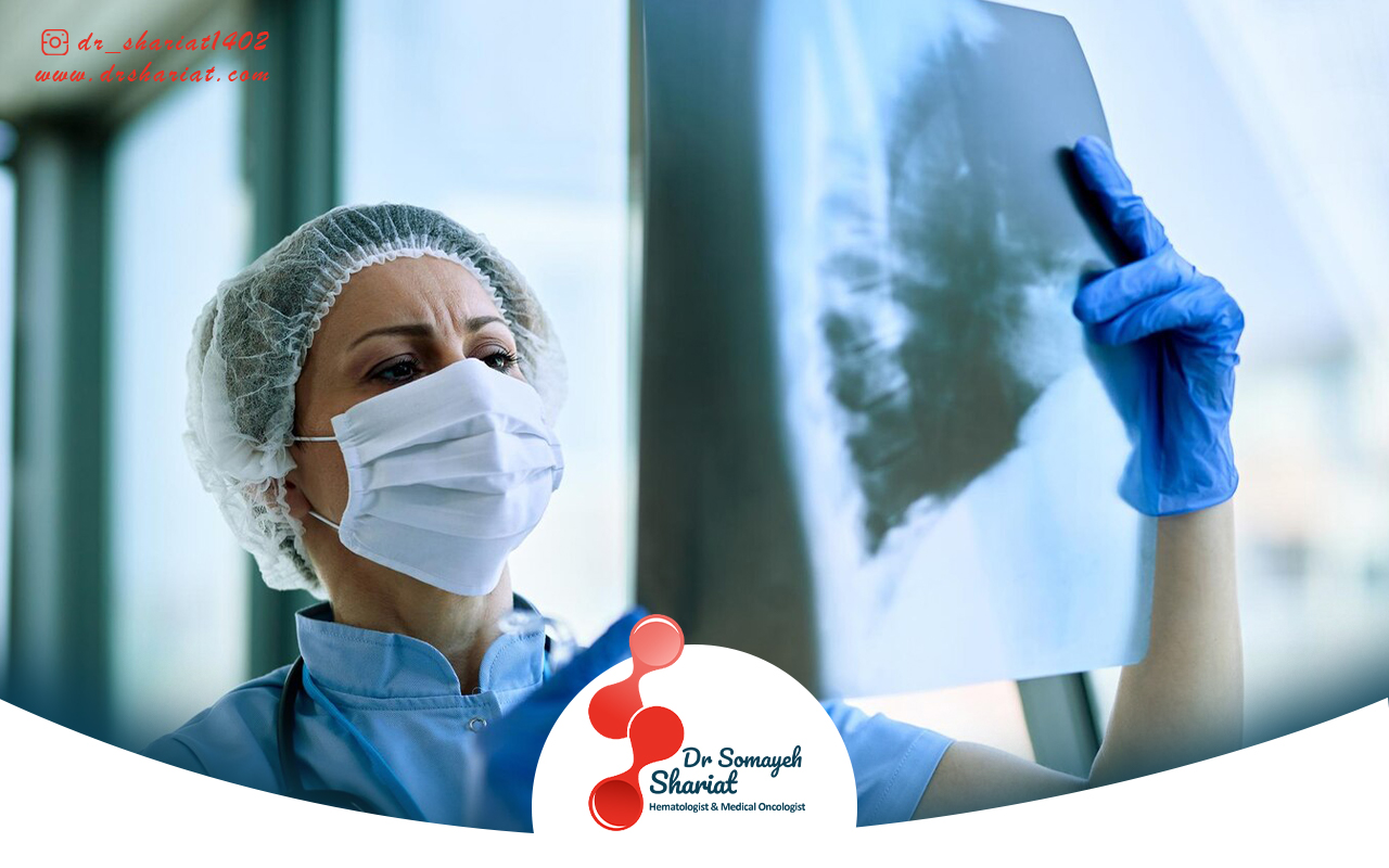 تاثیر سبک زندگی سالم در کاهش سرطان ریه