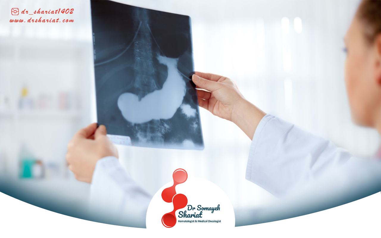 عوارض جانبی و مراقبت های پس از درمان سرطان پانکراس