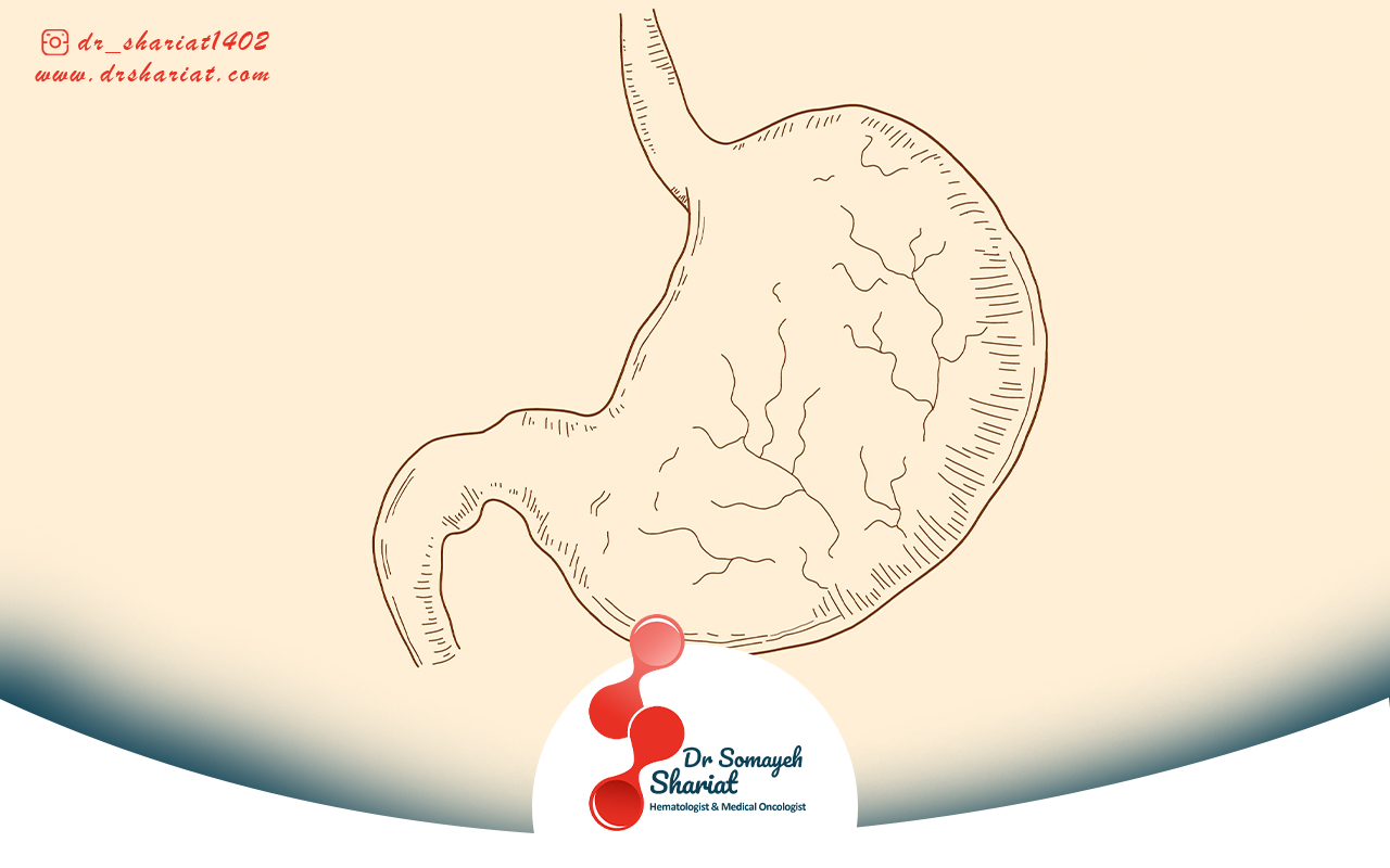 شیمی درمانی و پرتو درمانی برای سرطان معده