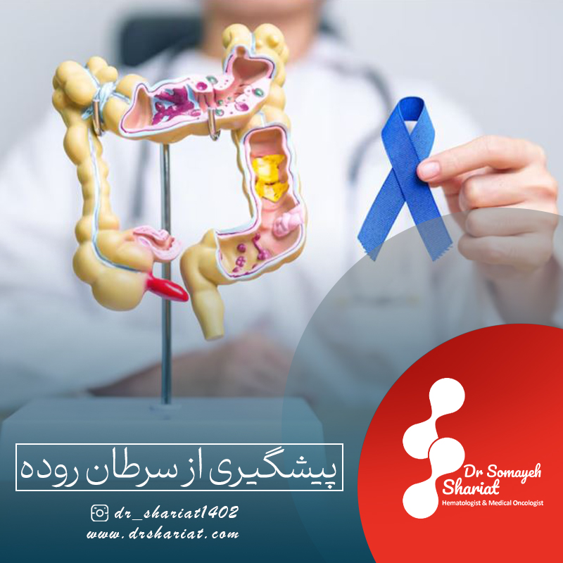 پیشگیری از سرطان روده
