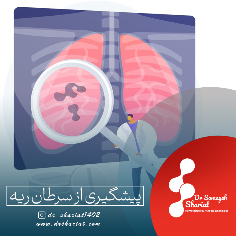 پیشگیری از سرطان ریه