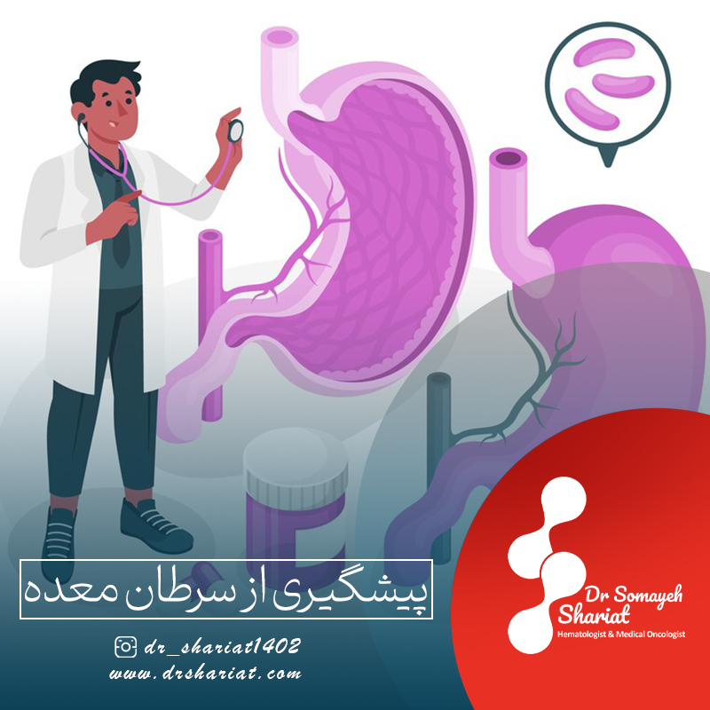 پیشگیری از سرطان معده