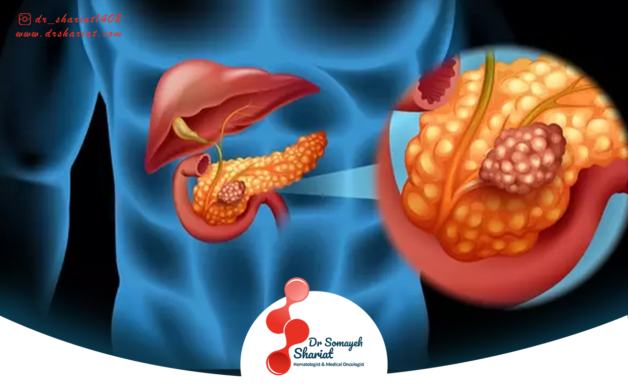 علائم و نشانه‌ های سرطان پانکراس