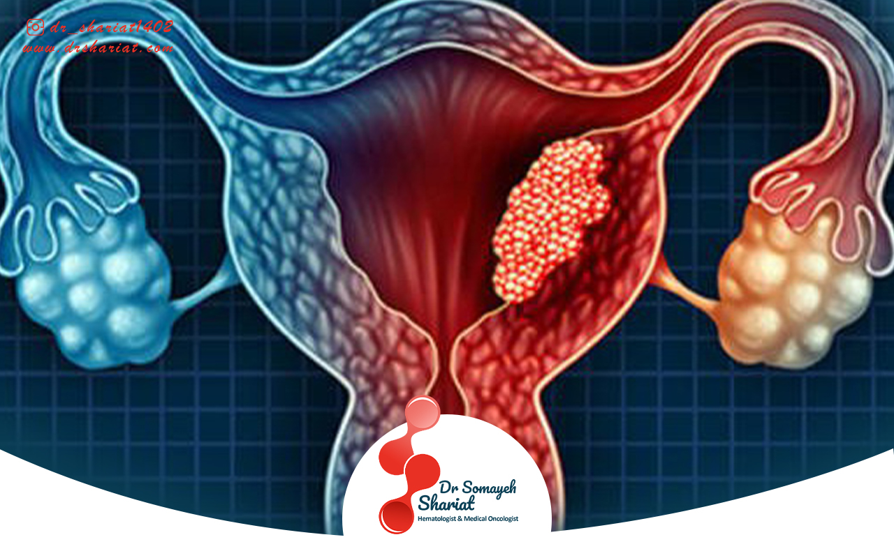 عوارض جانبی درمان های سرطان رحم