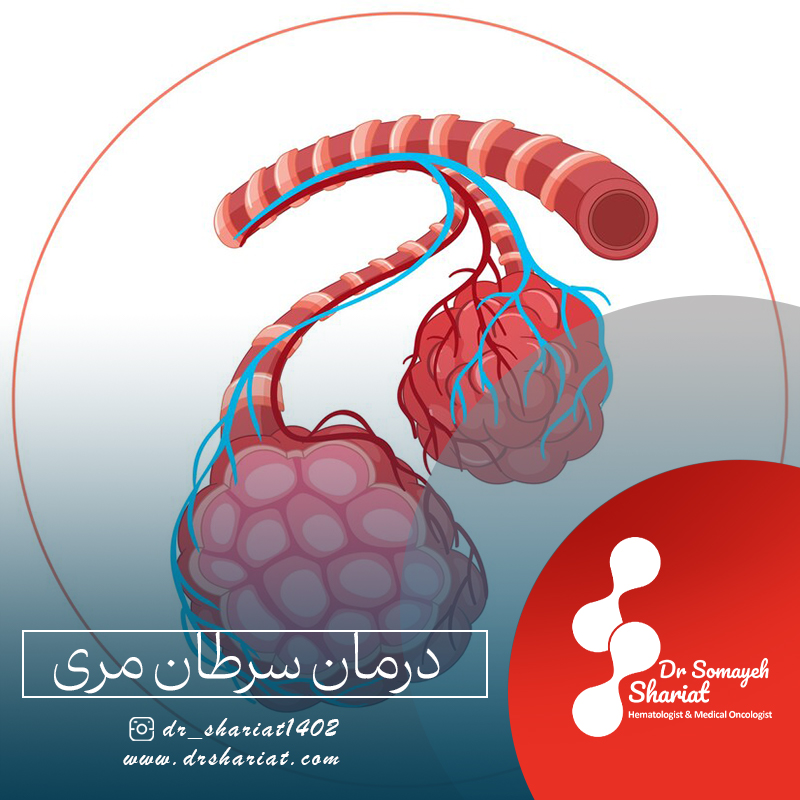 درمان سرطان مری