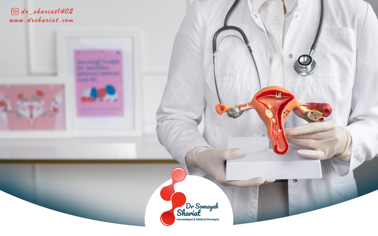 شیمی درمانی و پرتو درمانی برای سرطان تخمدان