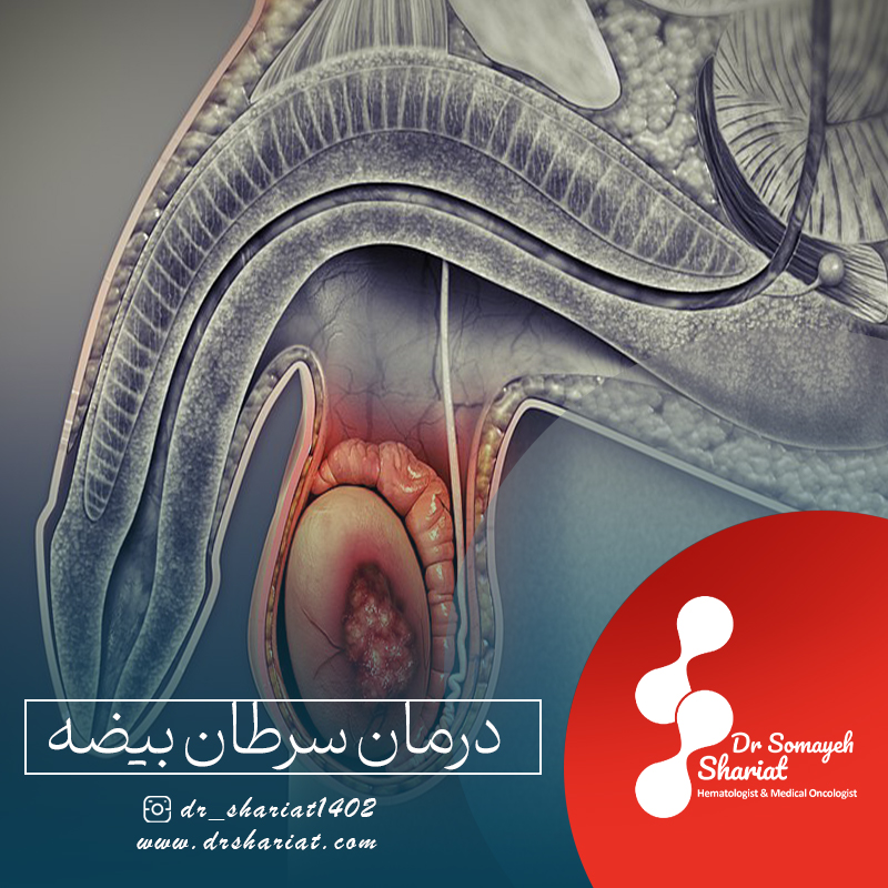 درمان سرطان بیضه