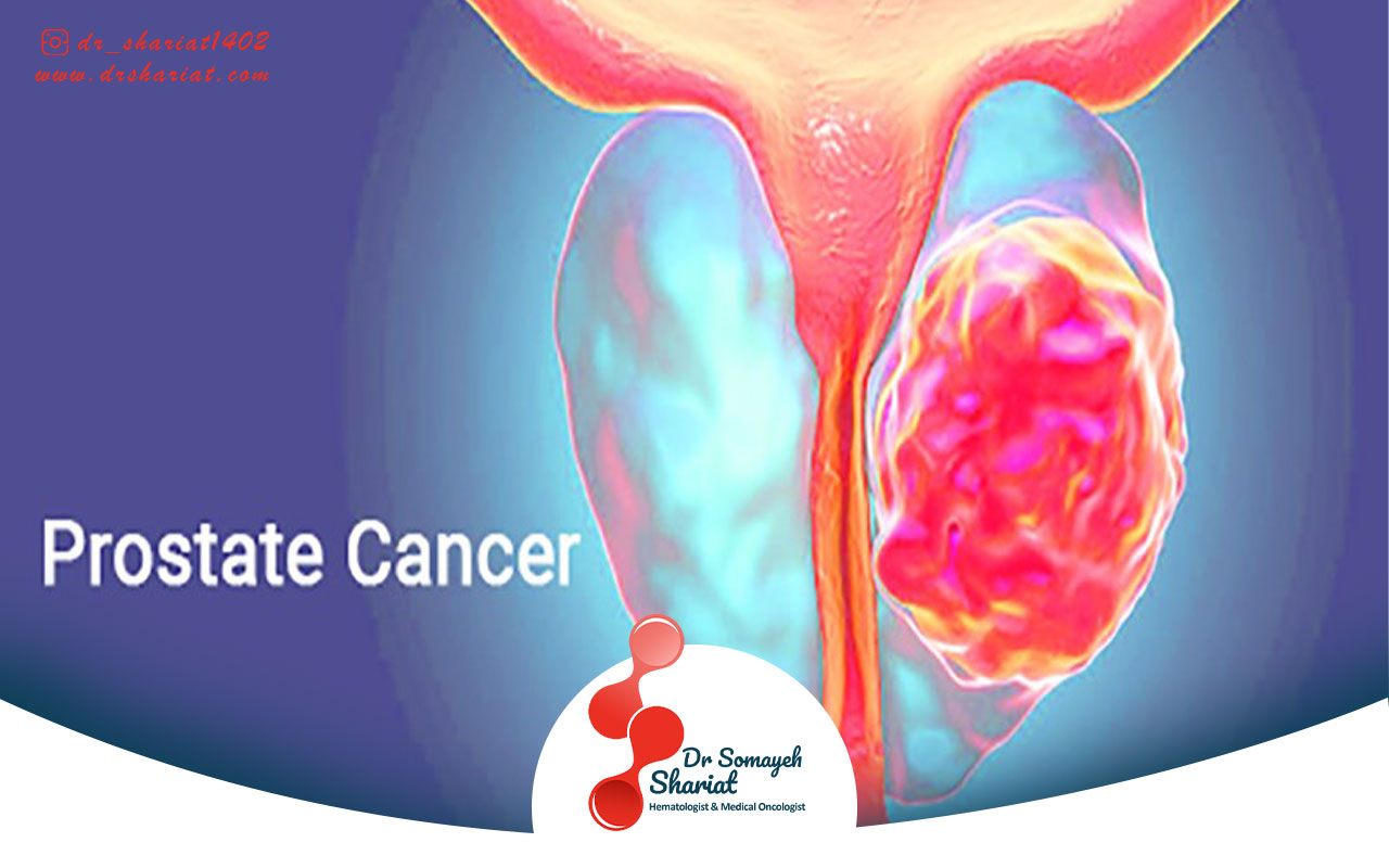 عوامل خطر و راه‌ های کاهش آنها برای سرطان پروستات
