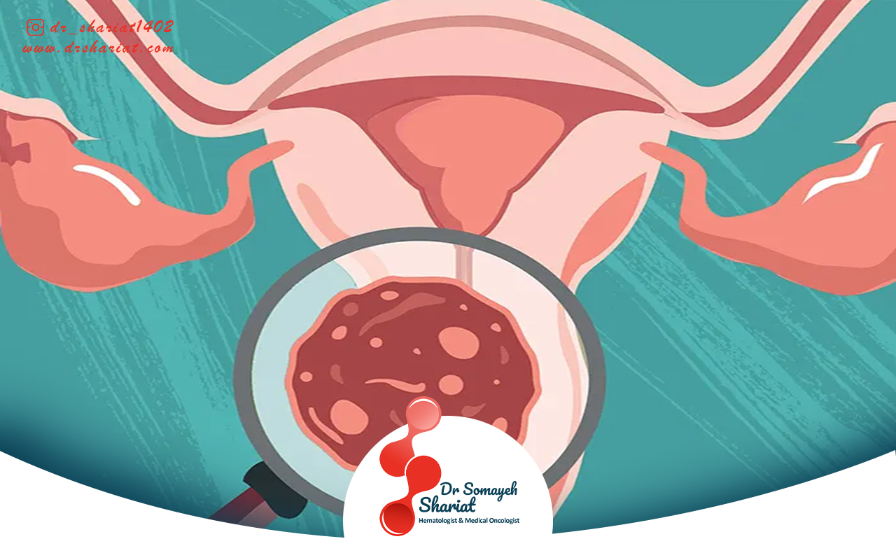 اهمیت غربالگری در پیشگیری از سرطان سرویکس