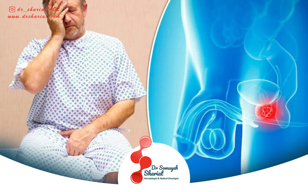 تاثیر عوامل محیطی بروز سرطان پروستات