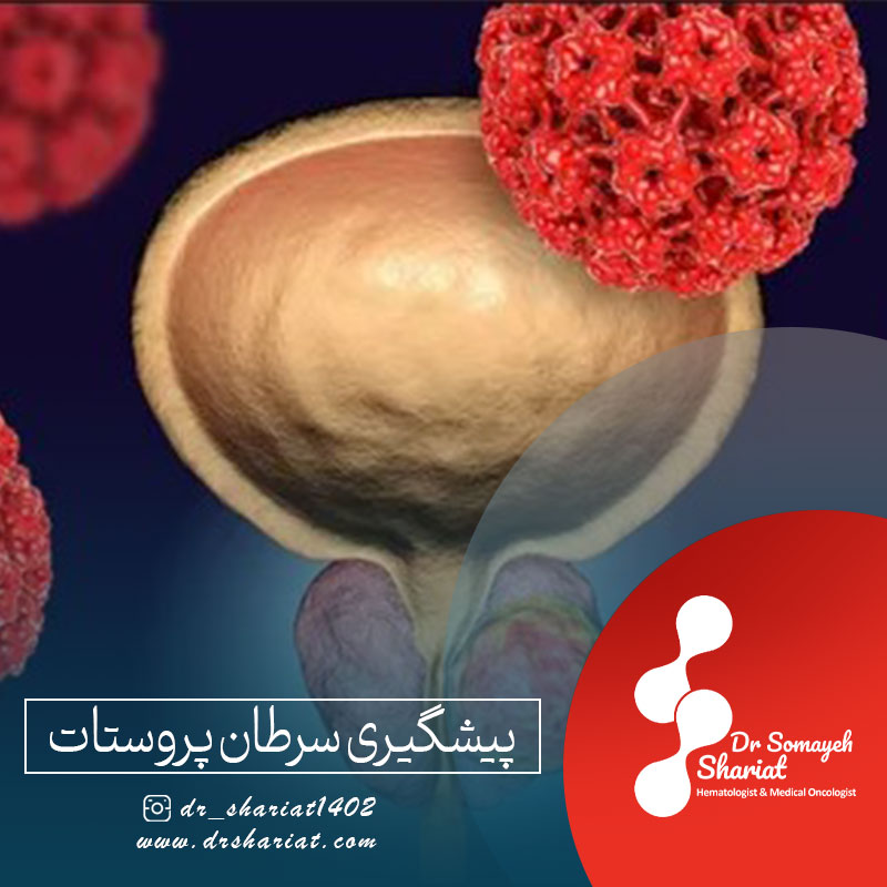 پیشگیری از سرطان پروستات