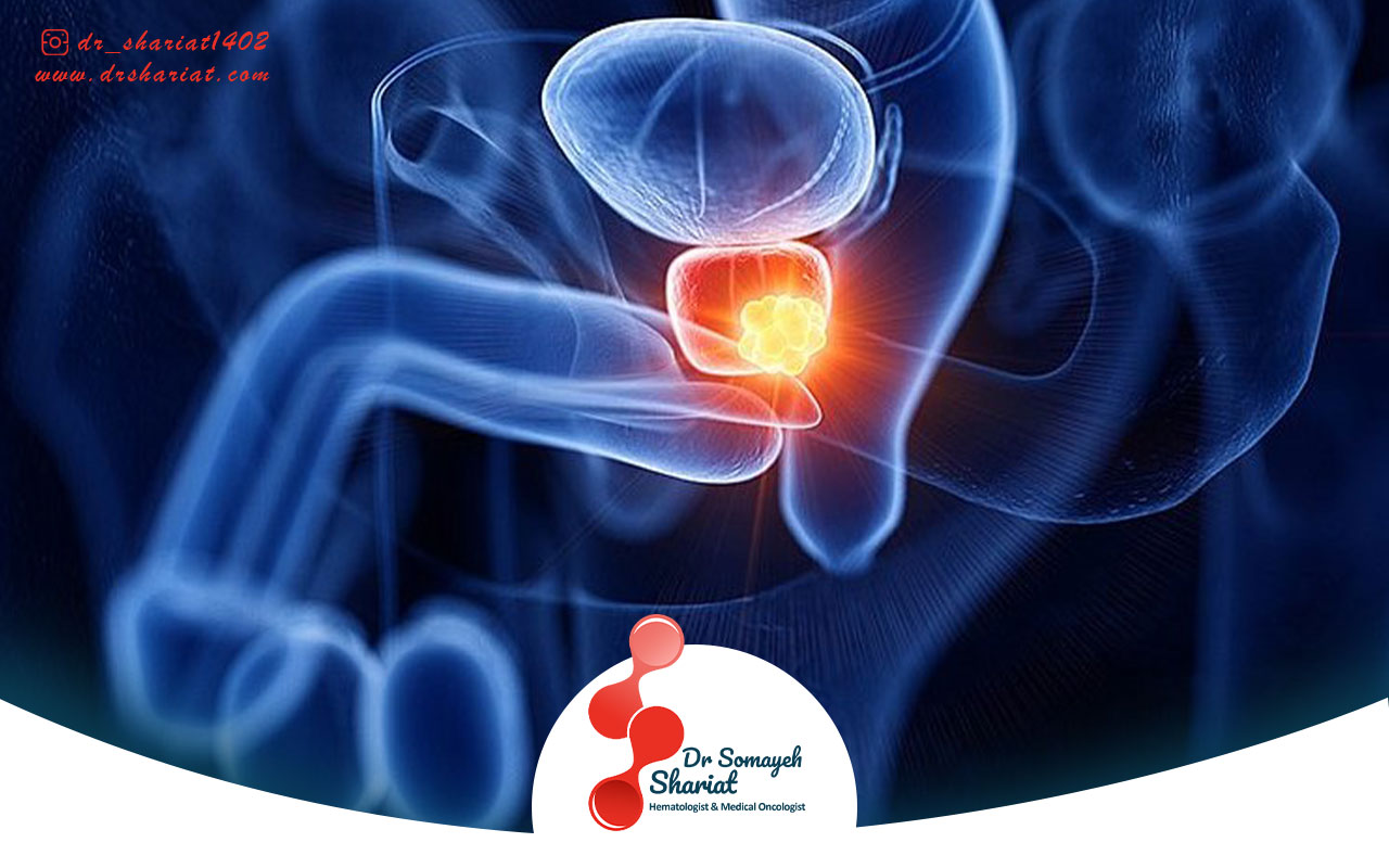 بررسی عوارض جانبی درمان‌های سرطان پروستات