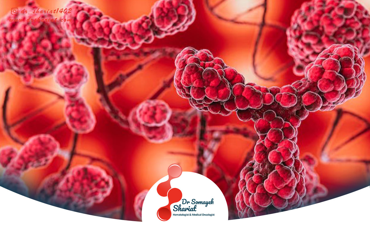 روش های درمانی مولتیپل میلوما