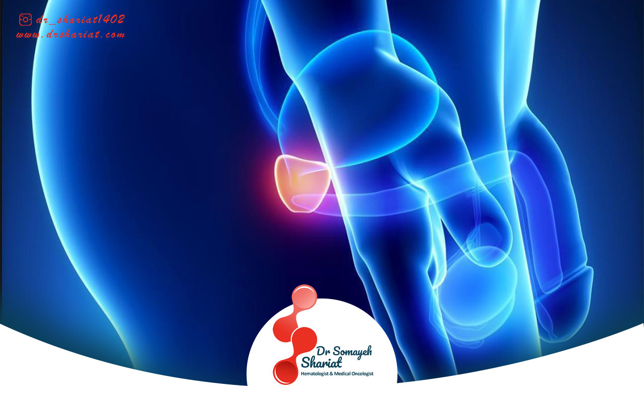 نقش تغذیه در پیشگیری از سرطان پروستات