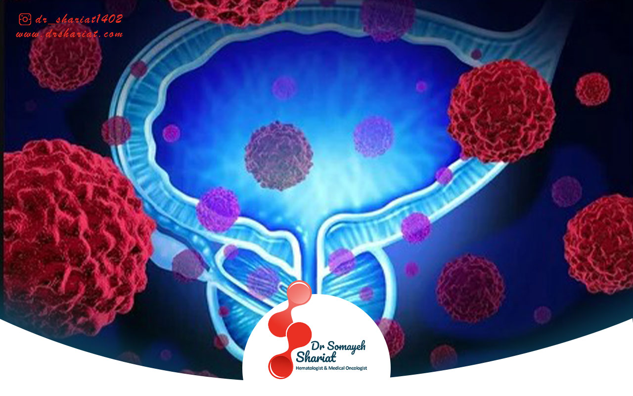 راه های تشخیص زود هنگام درمان پروستات