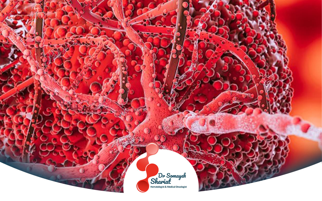 تاثیر ورزش و تغذیه بر پیشگیری و درمان مولتیپل میلوما