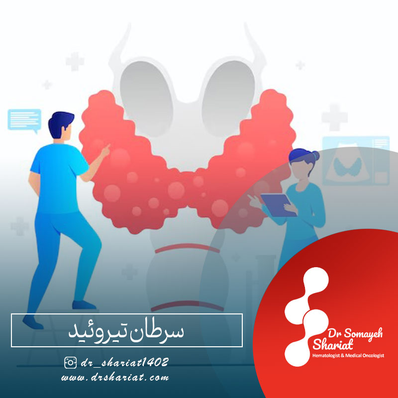سرطان تیروئید