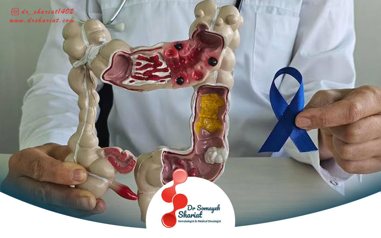 درمان سرطان رکتوم در خانه