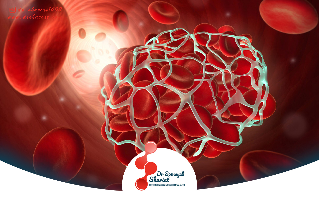 چه زمانی برای تشخیص اختلالات انعقادی اقدام کنیم؟